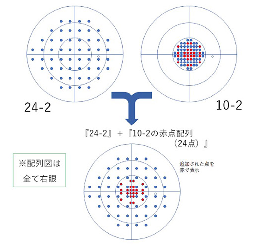 網膜電位計