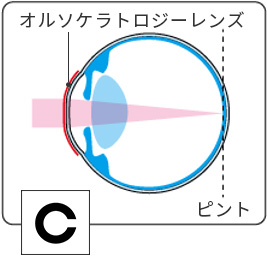 レンズ装着中の図解