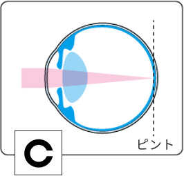 レンズ脱着後の図解