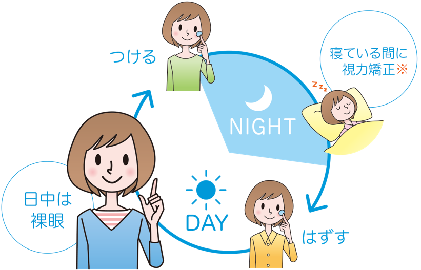 夜つける　寝ている間に視力矯正　朝はずす　日中は裸眼